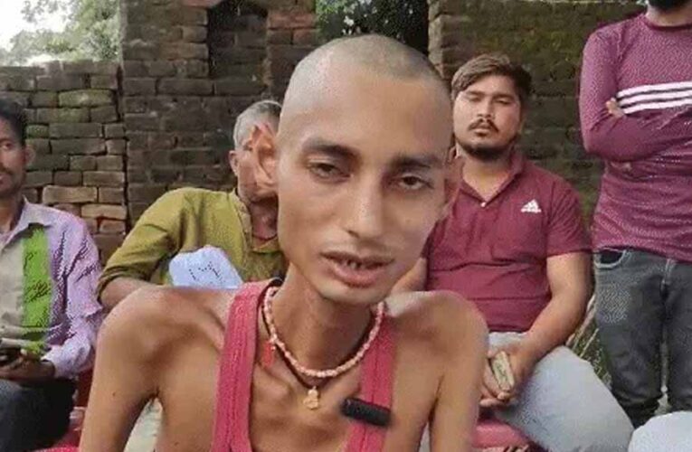 मरीज मनीष यादव को किया गया भर्ती, इलाज जारी