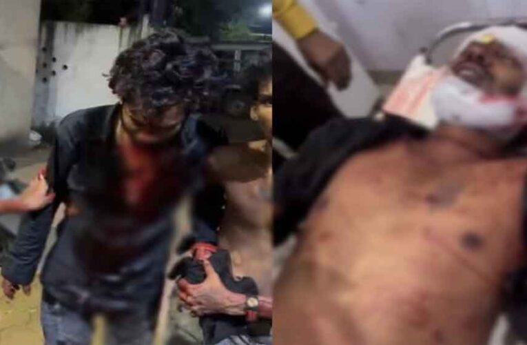छत्तीसगढ़-दुर्ग में पारिवारिक विवाद में चली तलवारें, युवकों ने एक-दूसरे को किया लहूलुहान