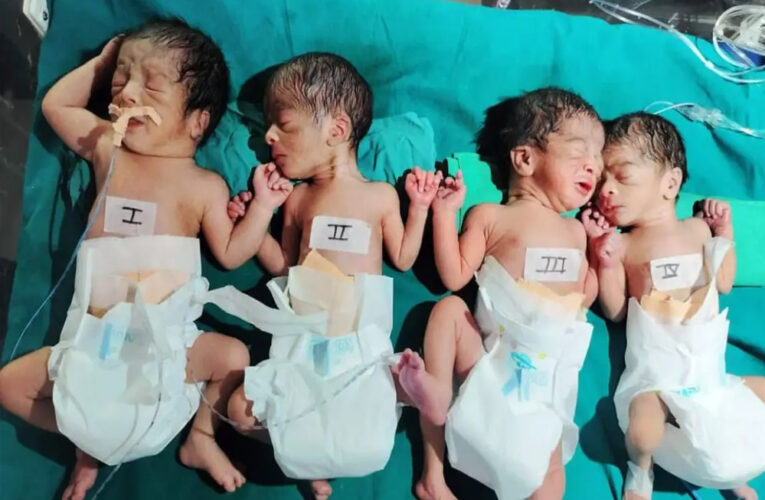 छत्तीसगढ़ : धमतरी जिले के गांव कौहाबाहरा में रहने वाली एक महिला ने एक साथ चार बच्चों को जन्म दिया