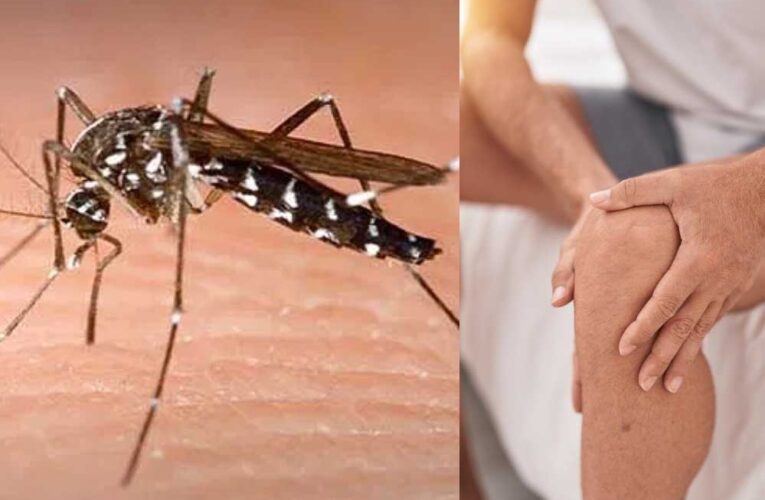 स्वास्थ्य विभाग की रिपोर्ट में खुलासा, इस साल अब तक चिकनगुनिया के मामले डेंगू से ज्यादा