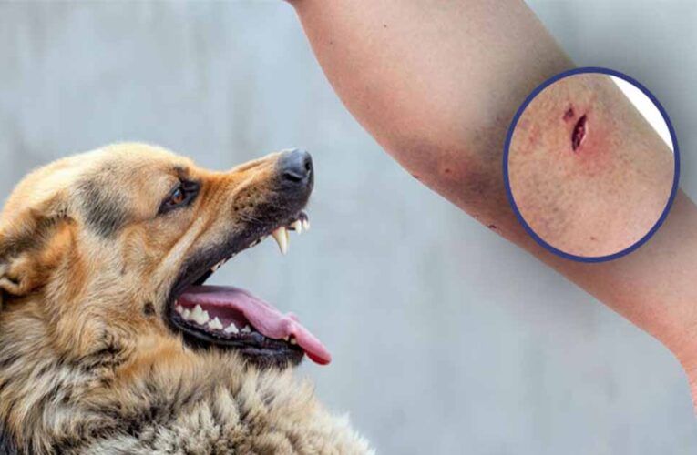 इंदौर में डॉग बाइट के मामले बढ़े, 7 महीने में 28,142 लोग बने शिकार