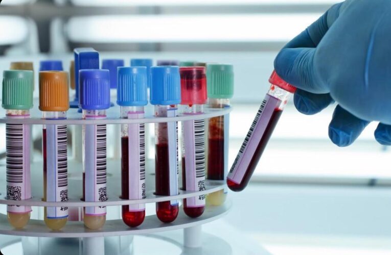 भारत में मिला दुनिया का सबसे दुर्लभ ब्लड ग्रुप, मेडिकल साइंस में मचा हलचल