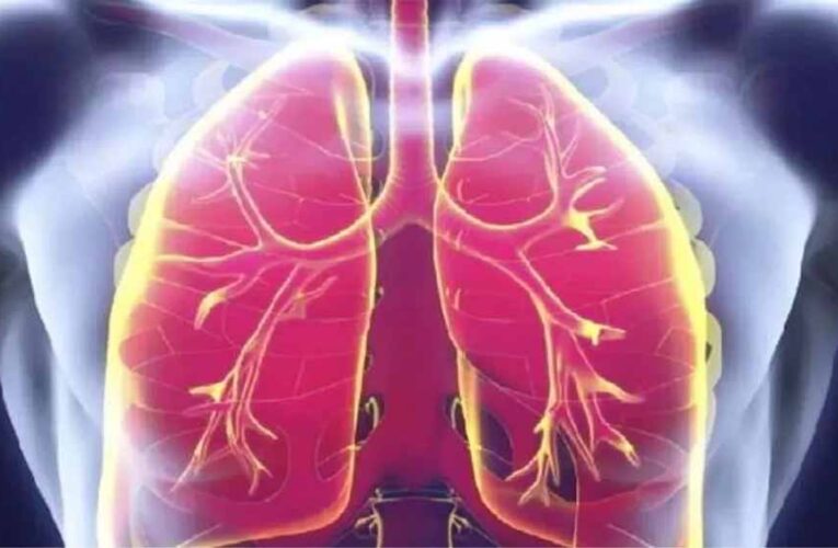 मध्य प्रदेश में ‘मेलिओइडोसिस’ का खतरा बढ़ा, लक्षणों से डॉक्टर भी हो रहे भ्रमित