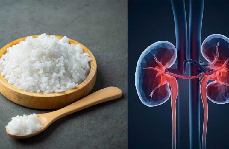नमक-चीनी से ज़्यादा खतरनाक मैदा और बोरिंग का पानी! किडनी को लेकर डॉक्टरों की सख्त चेतावनी