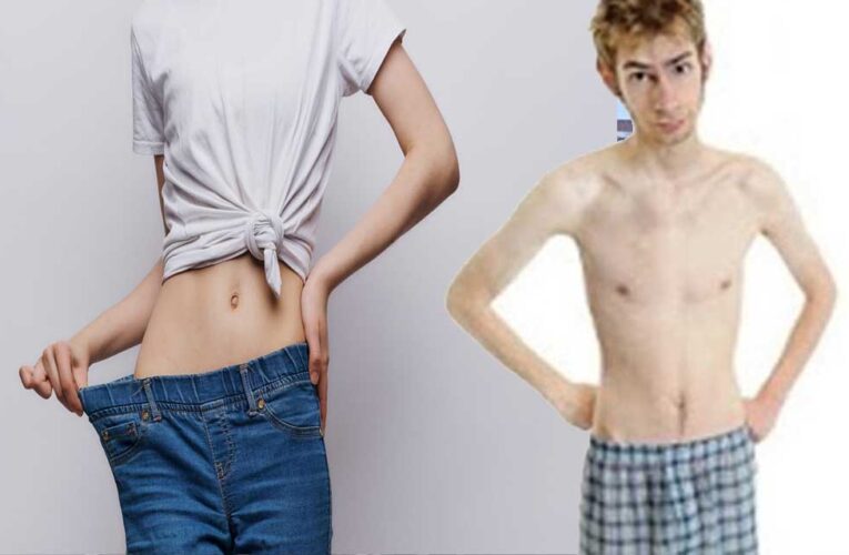 रिसर्च में खुलासा: बहुत दुबले लोगों में समय से पहले मौत का खतरा 3 गुना ज्यादा