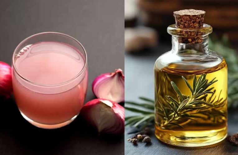प्याज बनाम रोजमेरी ऑयल: बालों की ग्रोथ के लिए कौन है ज्यादा कारगर?