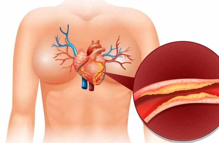 कोलेस्ट्रॉल क्या है और शरीर में इसकी क्या भूमिका होती है?