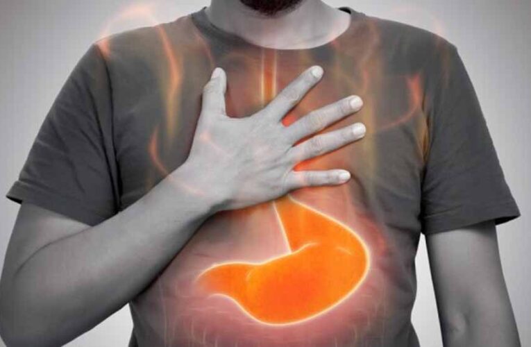 एसिड रिफ्लक्स सिर्फ मसालों की वजह से नहीं! जानिए 5 चौंकाने वाली कारण और बचाव के तरीके