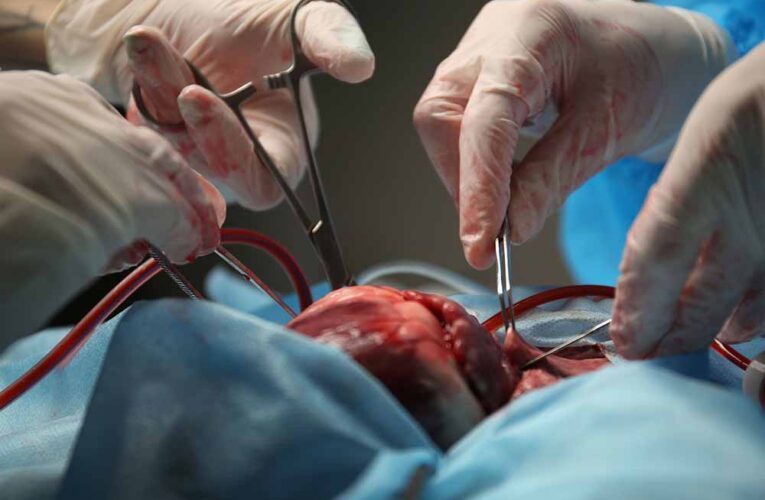 मौत से जिंदगी तक: पहला ट्रांसप्लांट जिसने दुनिया को हिला दिया!