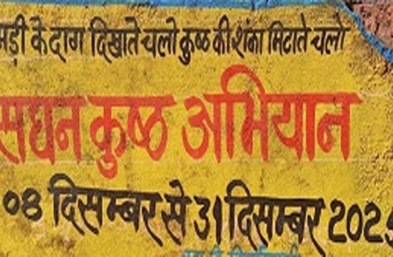 एमसीबी : सघन कुष्ठ खोज अभियान – घर-घर पहुंच रही स्वास्थ्य विभाग की टीम