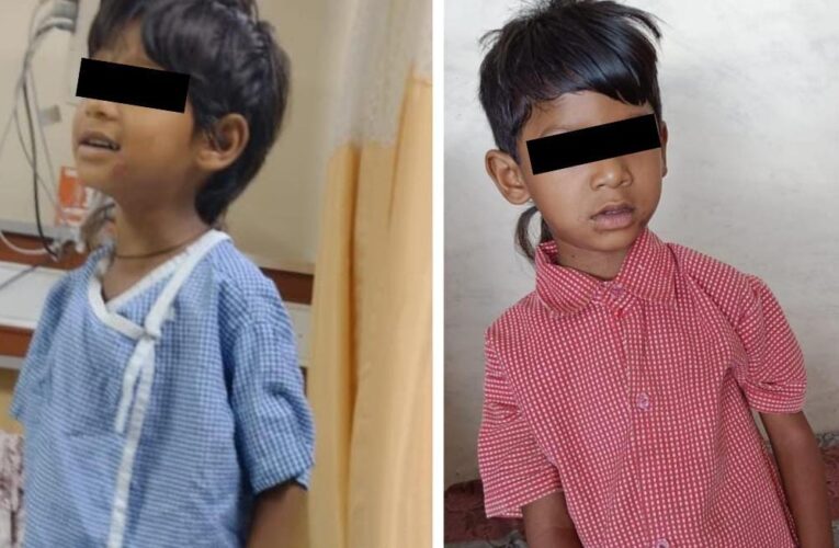 रायपुर : चिरायु योजना से नित्या राजवाड़े को मिला नया जीवन