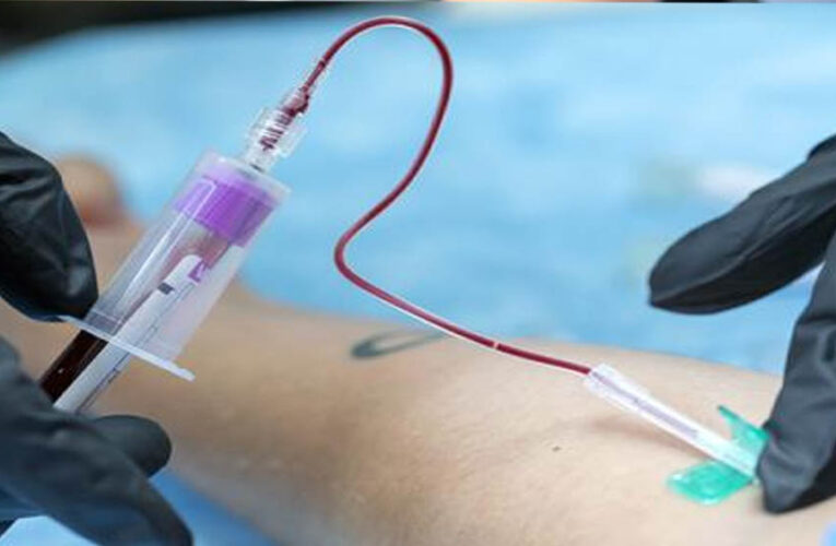 ब्लड टेस्ट से जानें अपनी जीवन प्रत्याशा, खून में छुपा है जिंदगी-मौत का राज