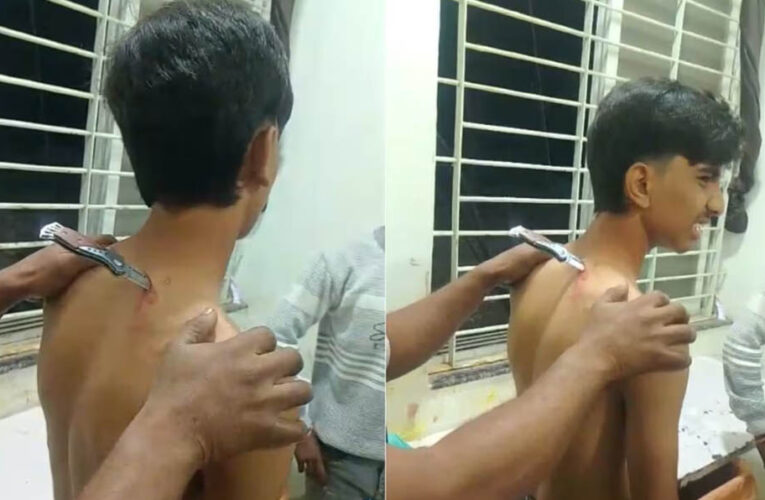 महिदपुर में मामूली विवाद के दौरान नाबालिग पर हमला, घायल 46 किमी दूर अस्पताल पहुंचा