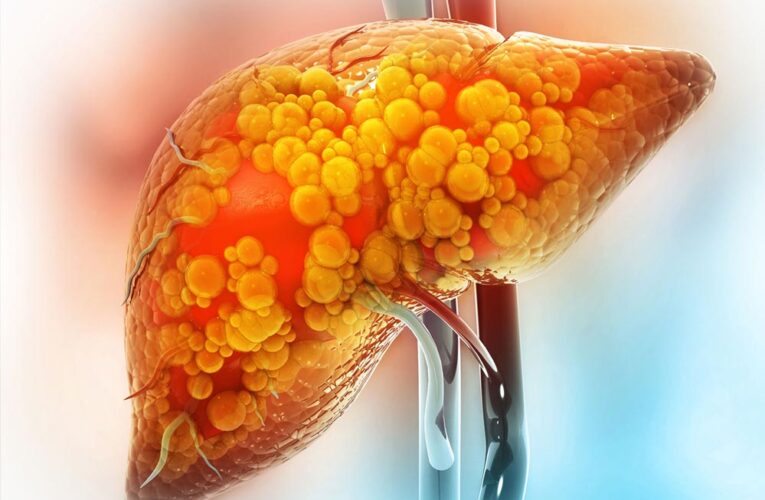 आइसक्रीम और च्युइंग गम खा रहे हैं? नई स्टडी में पता चला, ये लिवर के लिए हानिकारक