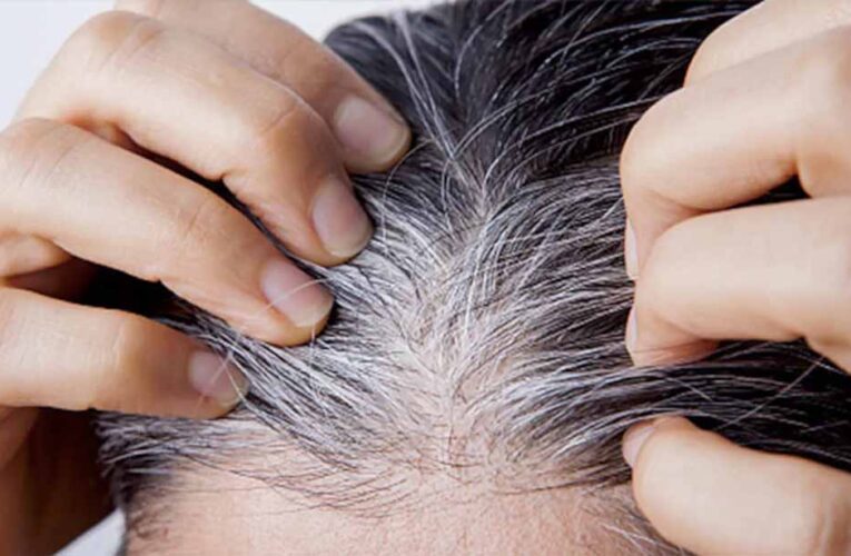 एक सफेद बाल उखाड़ने से क्या सच में निकलते हैं 10 नए? जानिए इस मिथक की सच्चाई और असरदार उपाय