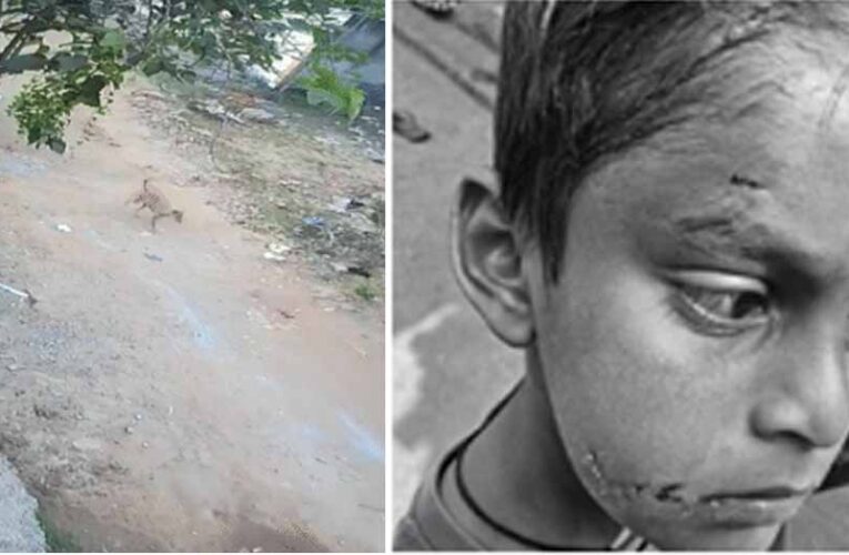 बिलासपुर में PM श्री स्कूल के अंदर कुत्ते ने पहली कक्षा के बच्चे को नोचा, बचाने दौड़ी टीचर पर भी किया हमला