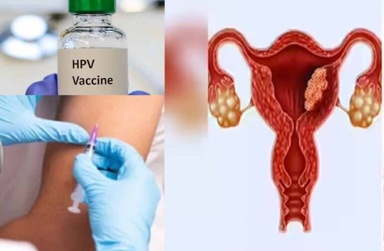 भारत में फेमस हैं HPV वैक्सीन से जुड़े 3 मिथक, डॉक्टर से जानें सही उम्र और सच्चाई