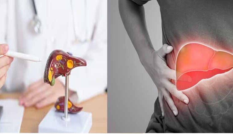 आपका लिवर हेल्दी है या खराब? घर बैठे 20 सेकेंड में अभी टेस्ट करें!