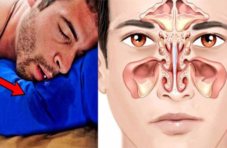 गहरी नींद का संकेत है या कोई बीमारी? सोते समय मुंह से लार बहने पर रहें अलर्ट?