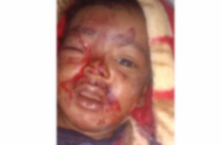 आंगन में खेल रहे 6 माह के मासूम को आवारा कुत्ते ने काटा, जिला अस्पताल में भर्ती