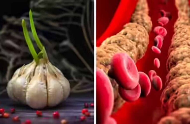 सुबह लहसुन खाना: क्या वाकई घटता है कोलेस्ट्रॉल? जानिए पूरी सच्चाई