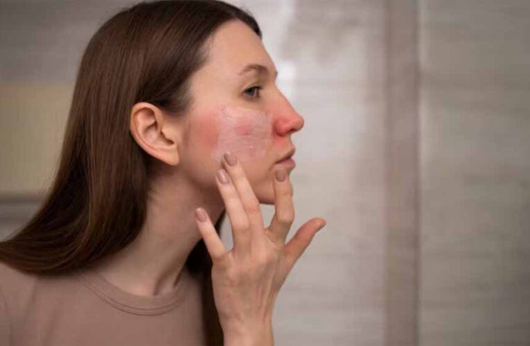 खूबसूरत त्वचा का दुश्मन! ये 3 फूड्स अंदर से कर रहे हैं स्किन डैमेज, तीसरा सबसे खतरनाक