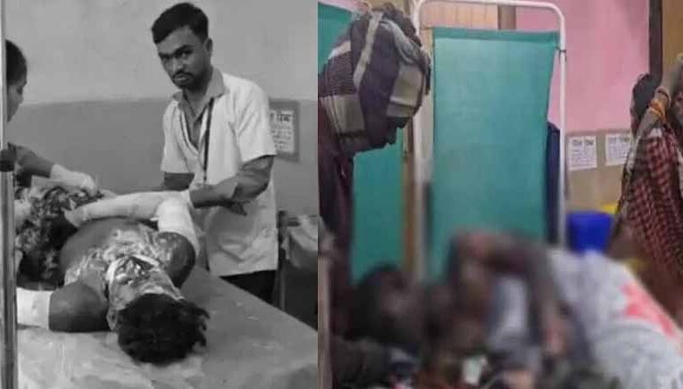 मंगल कार्बन प्लांट में भीषण ब्लास्ट: 9 माह के मासूम सहित 8 मजदूर झुलसे, हालत नाजुक