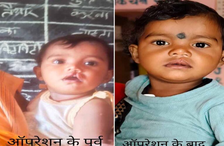 शासन की योजना से दूर हुई बेटी के भविष्य की चिंता, चिरायु दल ने लौटाई मासूम रंजना की मुस्कान