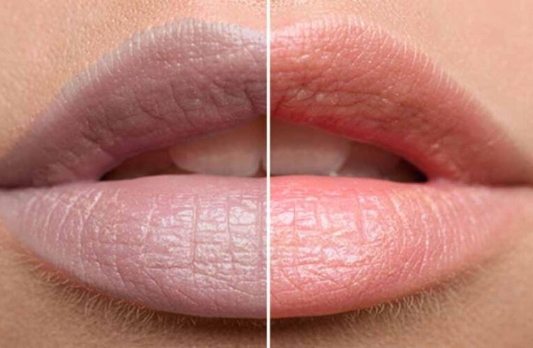 काले होंठों को नेचुरली गुलाबी बनाएंगे ये 7 घरेलू नुस्खे, महंगे लिप बाम की नहीं पड़ेगी जरूरत