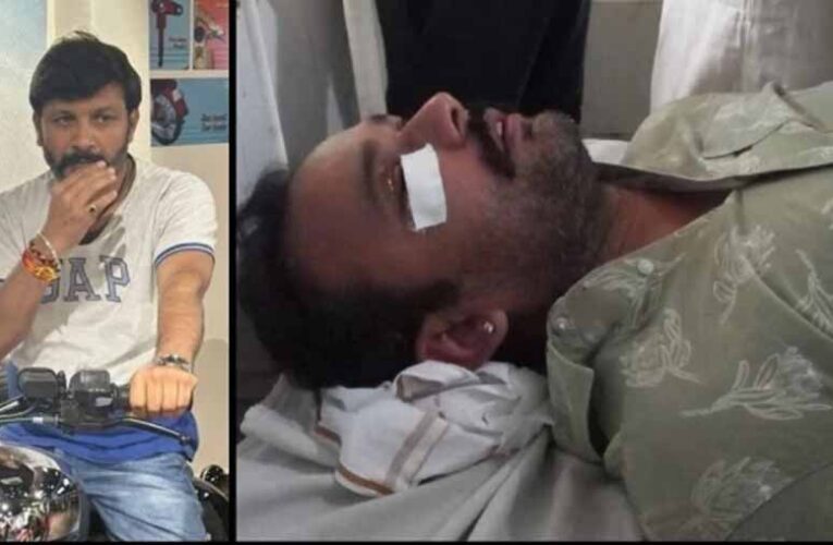 सतना में रोड टेंडर पर बवाल: हवाई फायरिंग के बाद पिस्टल की बट से हमला, CCTV खंगाल रही पुलिस