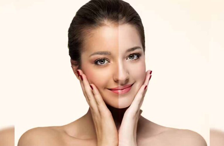टैनिंग हटाने के 5 आसान घरेलू नुस्खे, मिनटों में पाएँ चमकती त्वचा