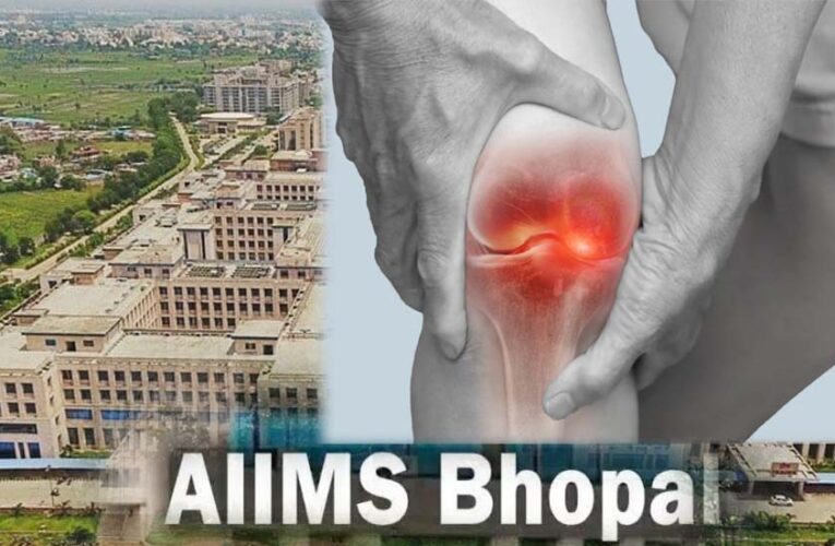 घुटनों के दर्द से मिलेगी परमानेंट मुक्ति, एम्स भोपाल और ग्वालियर आयुर्वेद संस्थान मिलकर खोजेंगे अचूक इलाज