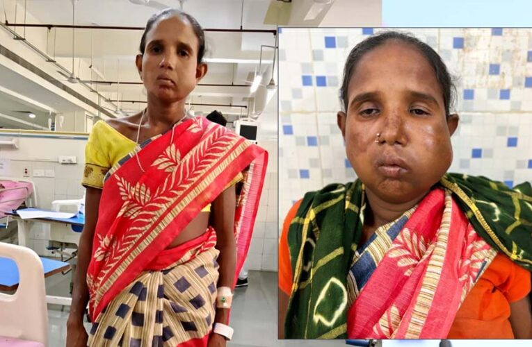 रायपुर: संजीवनी बना मेगा सुपर स्पेशलिटी हेल्थ कैंप, बुधरी मड़कम को मिला नया जीवन