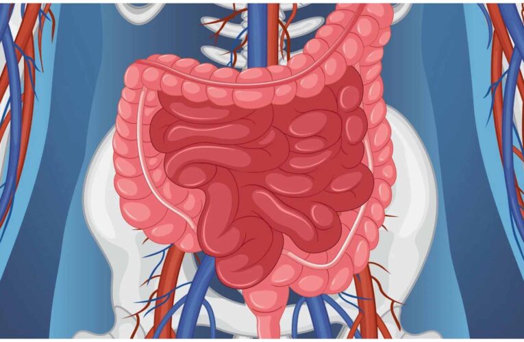 ज्यादा तीखा खाना पड़ सकता है भारी, पेट और पाचन पर डालता है असर