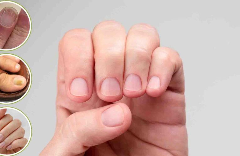 क्या आपके नाखून भी हो रहे हैं पीले या नीले? जानें शरीर में छिपी किन बीमारियों की ओर है यह इशारा