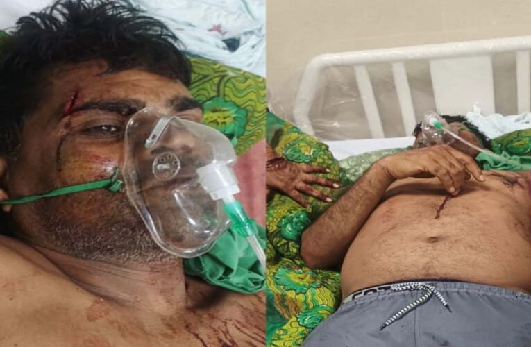 कुल्हाड़ी से हमला: गाली-गलौज का विरोध करने पर पूर्व जनपद सदस्य प्रतिनिधि पर जानलेवा वार
