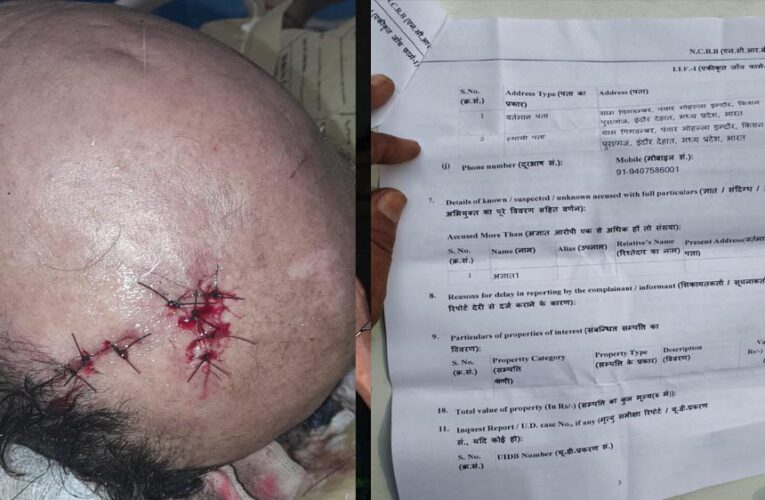 अधिमान्य पत्रकार नेतृत्व समिति के प्रदेश कार्यवाहक अध्यक्ष पर प्राण घातक हमला