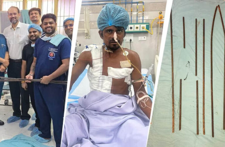 शरीर में आर-पार घुसे 4 लोहे के सरिये, KGMU के डॉक्टरों ने साढ़े आठ घंटे की सर्जरी से बचाई मजदूर की जान