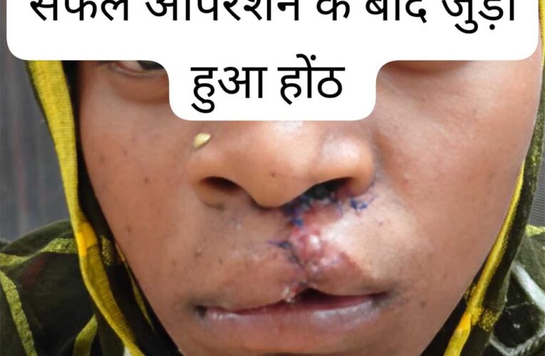 सफल सर्जरी से भीमे हेमला के चेहरे पर लौटी मुस्कान