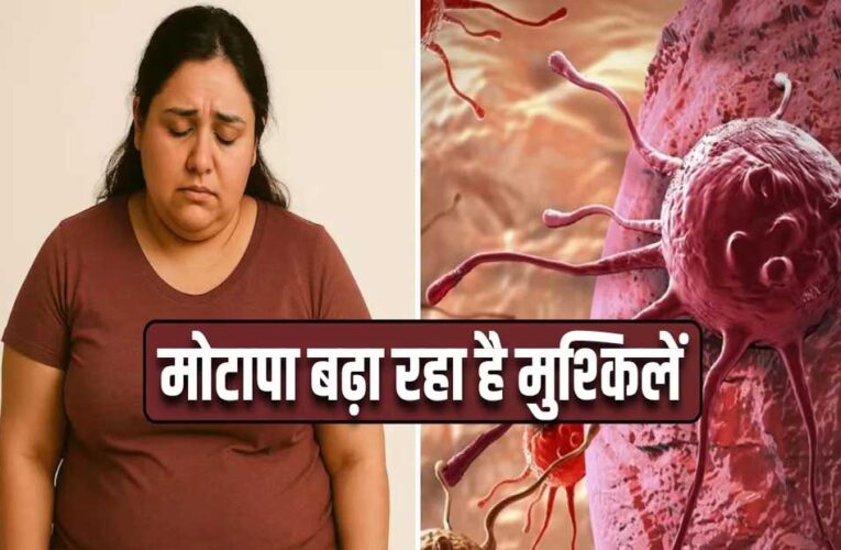 मोटापा-तनाव बढ़ा रहे कैंसर का खतरा! पुरुषों में ओरल तो महिलाओं में ब्रेस्ट कैंसर के मामले बढ़े